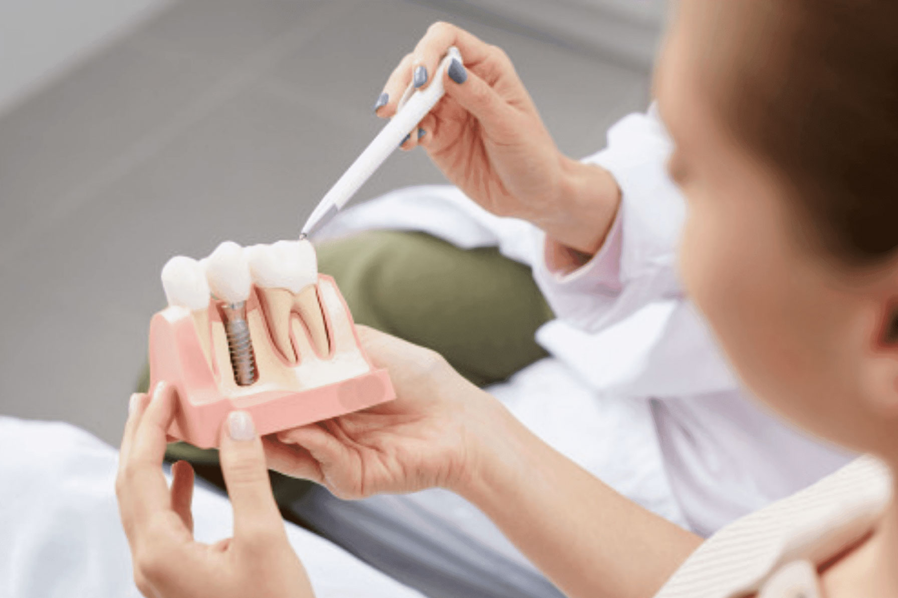 Implantes dentários: posso ou não fazer?